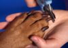 Broken Nails In Dogs: Here’s What You Should Know